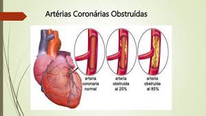 Associação entre HbA1c e Doença Arterial Coronariana