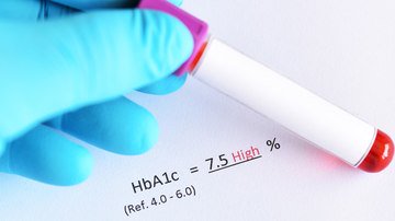 Níveis Crescentes de HbA1c Contribuem para o Risco de Eventos CV em Diabetes, DAC