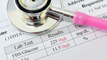Gerenciando Hiperglicemia em Diabetes Tipo 2: Onde Está a Prova do Pudim?