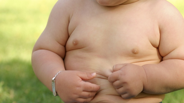 Estudo: Obesidade em Crianças Deve ser Definida por Questões de Saúde, não Apenas IMC