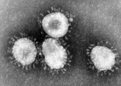 Covid-19 em Doenças Inflamatórias Imunomediadas – Série de Casos de Nova York