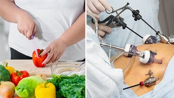 O Benefício da Perda de Peso no Diabetes é Semelhante por Meio de Cirurgia ou Dieta