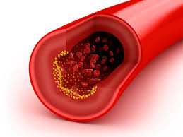 Colesterol de Lipoproteína de Alta Densidade na Doença Arterial Coronariana